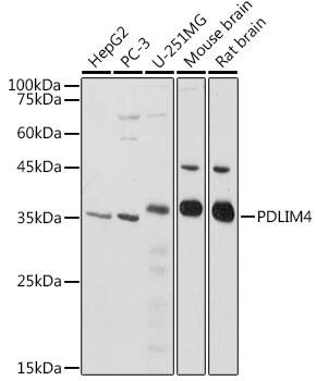 Western Blot: PDLIM4 Antibody [NBP3-37889] - Western blot analysis of various lysates using PDLIM4 Rabbit pAb at 1:1000 dilution.Secondary antibody: HRP-conjugated Goat anti-Rabbit IgG (H+L) at 1:10000 dilution.Lysates/proteins: 25ug per lane.Blocking buffer: 3% nonfat dry milk in TBST.Detection: ECL Basic Kit.Exposure time: 3s.