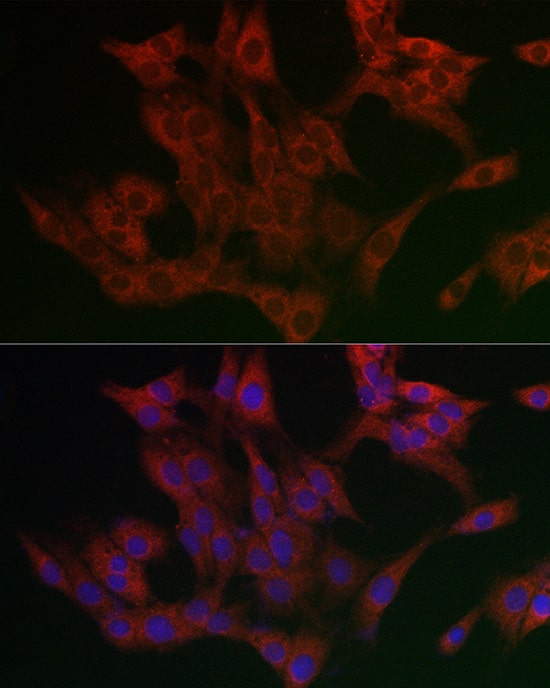 Immunocytochemistry/ Immunofluorescence: ETEA Antibody [NBP3-37892] - Immunofluorescence analysis of PC-12 cells using ETEA Rabbit pAb at dilution of 1:200 (40x lens). Secondary antibody: Cy3-conjugated Goat anti-Rabbit IgG (H+L) at 1:500 dilution. Blue: DAPI for nuclear staining.