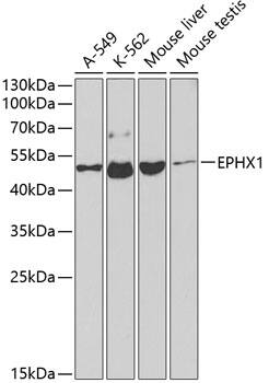 Western Blot: EPHX1 Antibody [NBP3-37901] - Western blot analysis of various lysates using EPHX1 Rabbit pAb at 1:1000 dilution.Secondary antibody: HRP-conjugated Goat anti-Rabbit IgG (H+L) at 1:10000 dilution.Lysates/proteins: 25ug per lane.Blocking buffer: 3% nonfat dry milk in TBST.