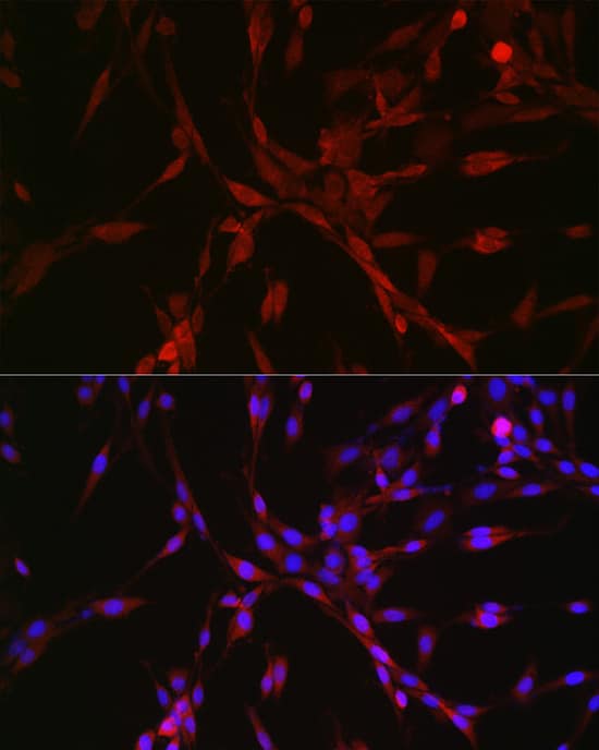 Immunocytochemistry/ Immunofluorescence: GATSL3 Antibody [NBP3-37902] - Immunofluorescence analysis of PC-12 cells using GATSL3 Rabbit pAb at dilution of 1:50 (40x lens). Secondary antibody: Cy3-conjugated Goat anti-Rabbit IgG (H+L) at 1:500 dilution. Blue: DAPI for nuclear staining.