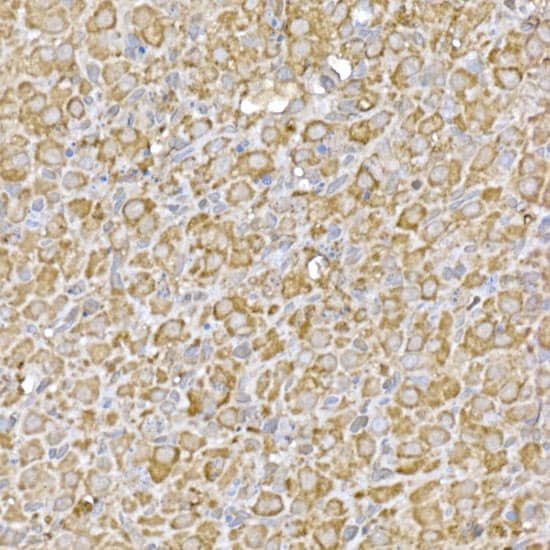 Immunohistochemistry: GATSL3 Antibody [NBP3-37902] - Immunohistochemistry analysis of paraffin-embedded Rat ovary using GATSL3 Rabbit pAb at dilution of 1:50 (40x lens). High pressure antigen retrieval performed with 0.01M Citrate Bufferr (pH 6.0) prior to IHC staining.
