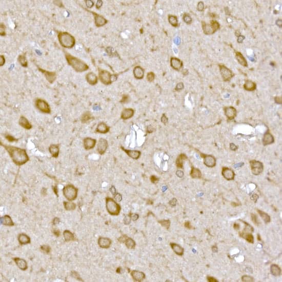 Immunohistochemistry: GATSL3 Antibody [NBP3-37902] - Immunohistochemistry analysis of paraffin-embedded Rat brain using GATSL3 Rabbit pAb at dilution of 1:50 (40x lens). High pressure antigen retrieval performed with 0.01M Citrate Bufferr (pH 6.0) prior to IHC staining.