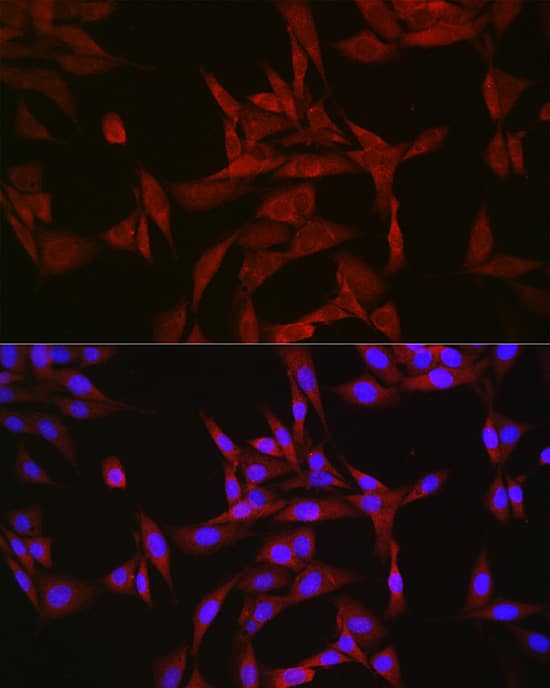 Immunocytochemistry/ Immunofluorescence: GATSL3 Antibody [NBP3-37902] - Immunofluorescence analysis of NIH/3T3 cells using GATSL3 Rabbit pAb at dilution of 1:50 (40x lens). Secondary antibody: Cy3-conjugated Goat anti-Rabbit IgG (H+L) at 1:500 dilution. Blue: DAPI for nuclear staining.