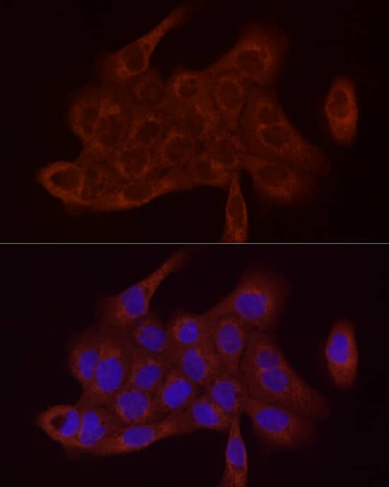 Immunocytochemistry/ Immunofluorescence SDHC Antibody