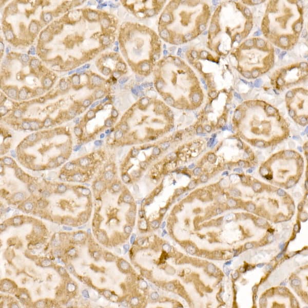 Immunohistochemistry: SDHC Antibody [NBP3-37905] - Immunohistochemistry analysis of paraffin-embedded Rat kidney using SDHC Rabbit pAb at dilution of 1:100 (40x lens). High pressure antigen retrieval performed with 0.01M Citrate Bufferr (pH 6.0) prior to IHC staining.