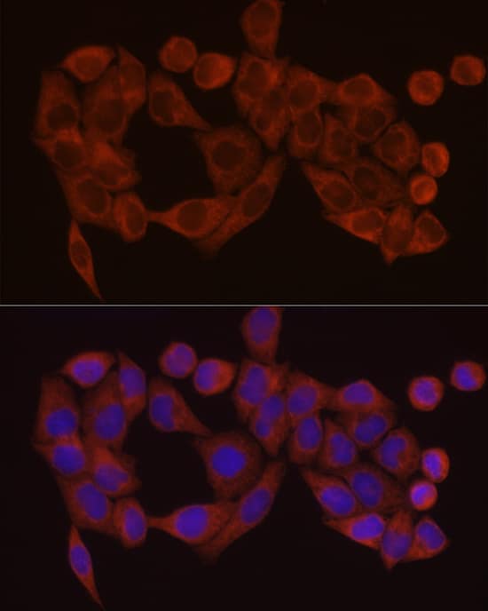 Immunocytochemistry/ Immunofluorescence: SDHC Antibody [NBP3-37905] - Immunofluorescence analysis of HeLa cells using SDHC Rabbit pAb at dilution of 1:100 (40x lens). Secondary antibody: Cy3-conjugated Goat anti-Rabbit IgG (H+L) at 1:500 dilution. Blue: DAPI for nuclear staining.