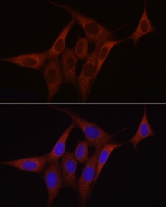 Immunocytochemistry/ Immunofluorescence: SDHC Antibody [NBP3-37905] - Immunofluorescence analysis of NIH/3T3 cells using SDHC Rabbit pAb at dilution of 1:100 (40x lens). Secondary antibody: Cy3-conjugated Goat anti-Rabbit IgG (H+L) at 1:500 dilution. Blue: DAPI for nuclear staining.