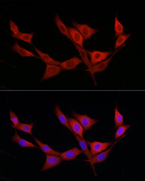 Immunocytochemistry/ Immunofluorescence: katanin-p80 Antibody [NBP3-37906] - Immunofluorescence analysis of NIH/3T3 cells using katanin-p80 Rabbit pAb at dilution of 1:200 (40x lens). Secondary antibody: Cy3-conjugated Goat anti-Rabbit IgG (H+L) at 1:500 dilution. Blue: DAPI for nuclear staining.