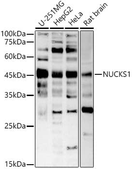 Western Blot: NUCKS1 Antibody [NBP3-37908] - Western blot analysis of various lysates using NUCKS1 Rabbit pAb at 1:1000 dilution.Secondary antibody: HRP-conjugated Goat anti-Rabbit IgG (H+L) at 1:10000 dilution.Lysates/proteins: 25ug per lane.Blocking buffer: 3% nonfat dry milk in TBST.Detection: ECL Basic Kit.Exposure time: 60s.