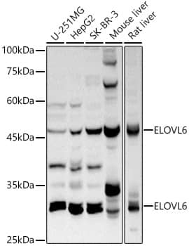 Western Blot: ELOVL6 Antibody [NBP3-37909] - Western blot analysis of lysates from Mouse kidney using ELOVL6 Rabbit pAb at 1:1000 dilution.Secondary antibody: HRP-conjugated Goat anti-Rabbit IgG (H+L) at 1:10000 dilution.Lysates/proteins: 25 ug per lane.Blocking buffer: 3% nonfat dry milk in TBST.Detection: ECL Basic Kit.Exposure time:30s.