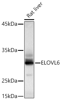 Western Blot: ELOVL6 Antibody [NBP3-37909] - Western Blot analysis of lysates from Rat liver using ELOVL6 Rabbit pAb at 1:1000 dilution incubated overnight at 4C.Secondary antibody: HRP Goat Anti-Rabbit IgG (H+L)at 1:10000 dilution. Lysates/proteins: 25 ug per lane.Blocking buffer: 3% nonfat dry milk in TBST.Detection: ECL Basic KitExposure time: 10 s.
