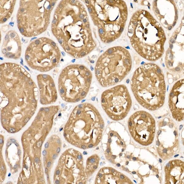 Immunohistochemistry: Sorbitol Dehydrogenase Antibody [NBP3-37912] - Immunohistochemistry analysis of paraffin-embedded Human kidney using Sorbitol Dehydrogenase Rabbit pAb at dilution of 1:100 (40x lens). High pressure antigen retrieval performed with 0.01M Citrate Bufferr (pH 6.0) prior to IHC staining.