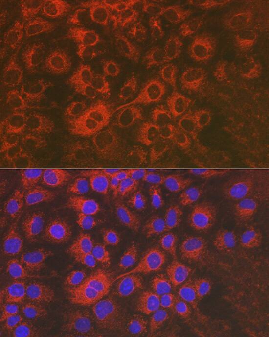 Immunocytochemistry/ Immunofluorescence: Sorbitol Dehydrogenase Antibody [NBP3-37912] - Immunofluorescence analysis of Huh7 cells using Sorbitol Dehydrogenase Rabbit pAb at dilution of 1:50 (40x lens). Secondary antibody: Cy3-conjugated Goat anti-Rabbit IgG (H+L) at 1:500 dilution. Blue: DAPI for nuclear staining.