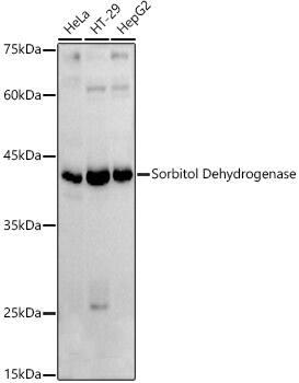 Western Blot: Sorbitol Dehydrogenase Antibody [NBP3-37912] - Western blot analysis of various lysates using Sorbitol Dehydrogenase Rabbit pAb at  1:1000 dilution.Secondary antibody: HRP-conjugated Goat anti-Rabbit IgG (H+L) at 1:10000 dilution.Lysates/proteins: 25ug per lane.Blocking buffer: 3% nonfat dry milk in TBST.Detection: ECL Basic Kit.Exposure time: 60s.