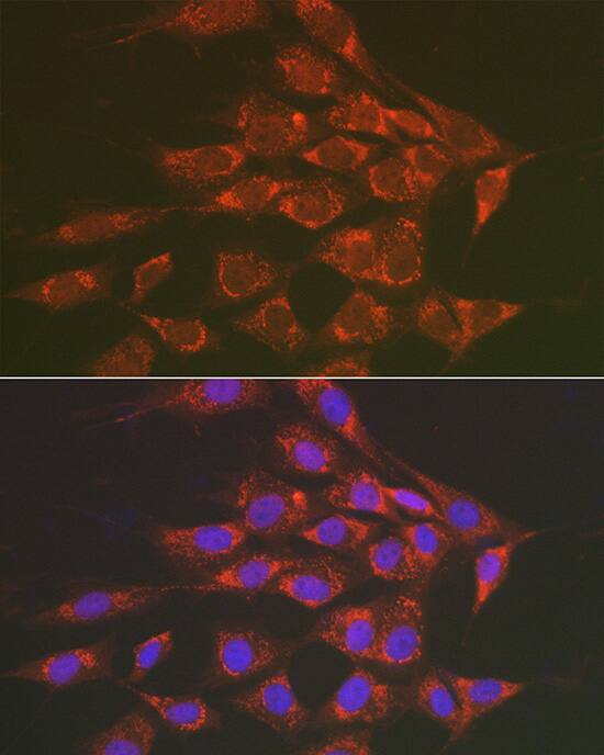 Immunocytochemistry/ Immunofluorescence: Sorbitol Dehydrogenase Antibody [NBP3-37912] - Immunofluorescence analysis of NIH/3T3 cells using Sorbitol Dehydrogenase Rabbit pAb at dilution of 1:50 (40x lens). Secondary antibody: Cy3-conjugated Goat anti-Rabbit IgG (H+L) at 1:500 dilution. Blue: DAPI for nuclear staining.