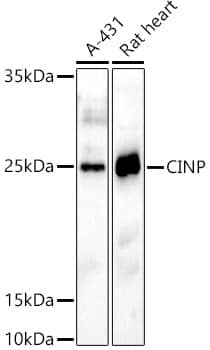 Western Blot: CINP Antibody [NBP3-37914] - Western blot analysis of various lysates using CINP Rabbit pAb at 1:1000 dilution.Secondary antibody: HRP-conjugated Goat anti-Rabbit IgG (H+L) at 1:10000 dilution.Lysates/proteins: 25ug per lane.Blocking buffer: 3% nonfat dry milk in TBST.Detection: ECL Basic Kit.Exposure time: 180s.