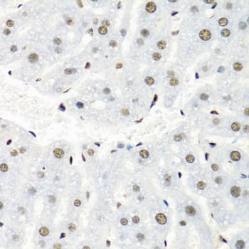 Immunohistochemistry: hnRNP-R Antibody [NBP3-37918] - Immunohistochemistry analysis of paraffin-embedded Mouse liver using hnRNP-R Rabbit pAb at dilution of 1:100 (40x lens). Microwave antigen retrieval performed with 0.01M PBS Buffer (pH 7.2) prior to IHC staining.
