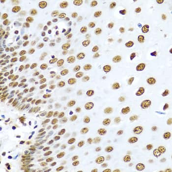 Immunohistochemistry hnRNP-R Antibody - BSA Free