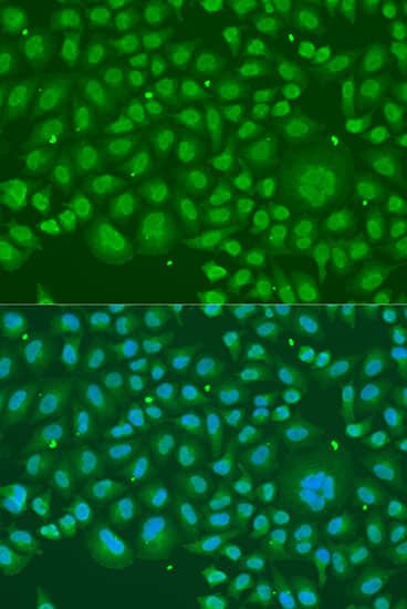 Immunocytochemistry/ Immunofluorescence: hnRNP-R Antibody [NBP3-37918] - Immunofluorescence analysis of U2OS cells using hnRNP-R Rabbit pAb at dilution of 1:100. Secondary antibody: Cy3-conjugated Goat anti-Rabbit IgG (H+L) at 1:500 dilution. Blue: DAPI for nuclear staining.