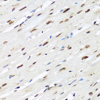 Immunohistochemistry: hnRNP-R Antibody [NBP3-37918] - Immunohistochemistry analysis of paraffin-embedded Rat heart using hnRNP-R Rabbit pAb at dilution of 1:100 (40x lens). Microwave antigen retrieval performed with 0.01M PBS Buffer (pH 7.2) prior to IHC staining.