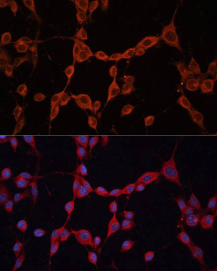 Immunocytochemistry/ Immunofluorescence G protein alpha-13 Antibody