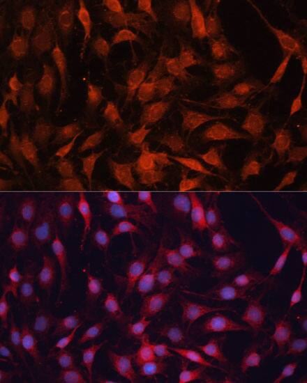 Immunocytochemistry/ Immunofluorescence G protein alpha-13 Antibody