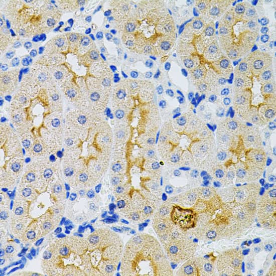 Immunohistochemistry: G protein alpha-13 Antibody [NBP3-37921] - Immunohistochemistry analysis of paraffin-embedded Mouse kidney using G protein alpha-13 Rabbit pAb (40x lens). Microwave antigen retrieval performed with 0.01M PBS Buffer (pH 7.2) prior to IHC staining.