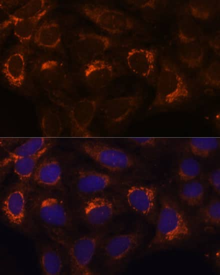 Immunocytochemistry/ Immunofluorescence HIBADH Antibody - BSA Free