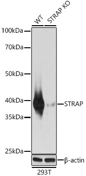 <b>Genetic Strategies Validation. </b>Western Blot: STRAP Antibody [NBP3-37924] - Western Blot analysis of lysates from wild type(WT) and STRAP knockout (KO) HeLa cells, using STRAP Rabbit pAb at 1:1000 dilution.Secondary antibody: HRP Goat Anti-Rabbit IgG (H+L) at 1:10000 dilution.Lysates/proteins: 25ug per lane.Blocking buffer: 3% nonfat dry milk in TBST.Detection: ECL Basic Kit.Exposure time: 1s.