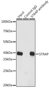 Immunoprecipitation: STRAP Antibody [NBP3-37924] - Immunoprecipitation analysis of 200 ug extracts of HeLa cells using 3 ug STRAP antibody. Western blot was performed from the immunoprecipitate using STRAP antibody at a dilution of 1:1000.