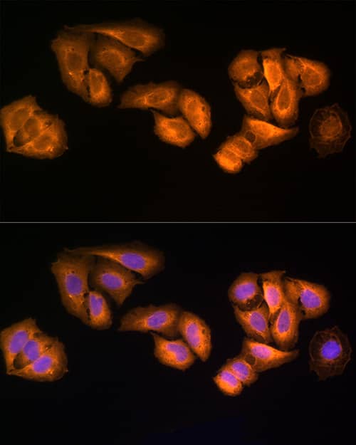 Immunocytochemistry/ Immunofluorescence: STRAP Antibody [NBP3-37924] - Immunofluorescence analysis of U2OS cells using STRAP Rabbit pAb at dilution of 100 (40x lens). Secondary antibody: Cy3-conjugated Goat anti-Rabbit IgG (H+L) at 1:500 dilution. Blue: DAPI for nuclear staining.