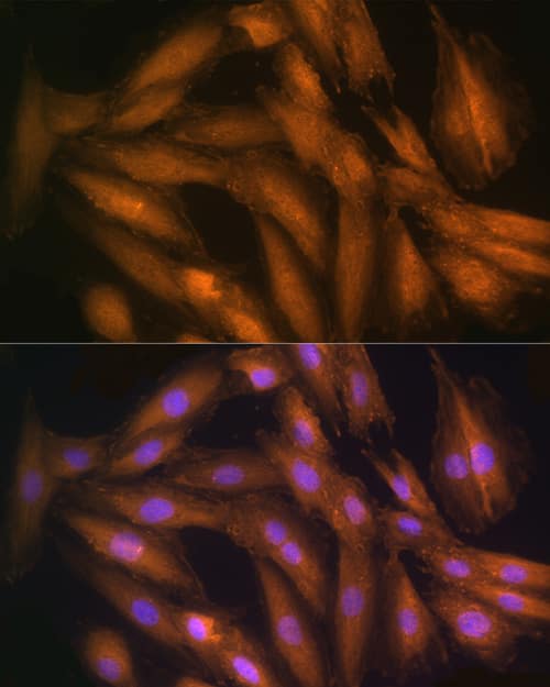 Immunocytochemistry/ Immunofluorescence: STRAP Antibody [NBP3-37924] - Immunofluorescence analysis of H9C2 cells using STRAP Rabbit pAb at dilution of 100 (40x lens). Secondary antibody: Cy3-conjugated Goat anti-Rabbit IgG (H+L) at 1:500 dilution. Blue: DAPI for nuclear staining.