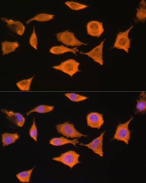 Immunocytochemistry/ Immunofluorescence: STRAP Antibody [NBP3-37924] - Immunofluorescence analysis of L929 cells using STRAP Rabbit pAb at dilution of 100 (40x lens). Secondary antibody: Cy3-conjugated Goat anti-Rabbit IgG (H+L) at 1:500 dilution. Blue: DAPI for nuclear staining.