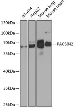 Western Blot: PACSIN2 Antibody [NBP3-37926] - Western blot analysis of various lysates using PACSIN2 Rabbit pAb at 1:1000 dilution.Secondary antibody: HRP-conjugated Goat anti-Rabbit IgG (H+L) at 1:10000 dilution.Lysates/proteins: 25ug per lane.Blocking buffer: 3% nonfat dry milk in TBST.Detection: ECL Basic Kit.Exposure time: 90s.