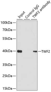 Western Blot: TWF2 Antibody [NBP3-37927] - Western blot analysis of various lysates using TWF2 Rabbit pAb at 1:1000 dilution. Secondary antibody: HRP-conjugated Goat anti-Rabbit IgG (H+L) at 1:10000 dilution. Lysates / proteins: 25 ug per lane. Blocking buffer: 3 % nonfat dry milk in TBST. Detection: ECL Basic Kit. Exposure time: 180s.