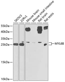 Western Blot: MLC1SA Antibody [NBP3-37928] - Western blot analysis of various lysates using MLC1SA Rabbit pAb at 1:1000 dilution.Secondary antibody: HRP-conjugated Goat anti-Rabbit IgG (H+L) at 1:10000 dilution.Lysates/proteins: 25ug per lane.Blocking buffer: 3% nonfat dry milk in TBST.Detection: ECL Enhanced Kit.Exposure time: 90s.