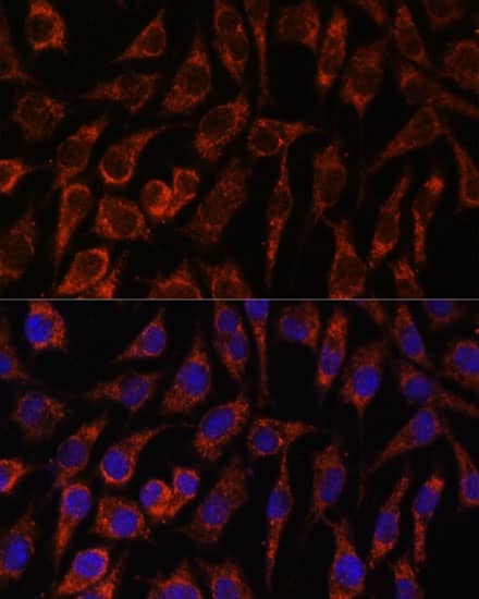 Immunocytochemistry/ Immunofluorescence: NUP210 Antibody [NBP3-37931] - Immunofluorescence analysis of L929 cells using NUP210 Rabbit pAb at dilution of 1:100. Secondary antibody: Cy3-conjugated Goat anti-Rabbit IgG (H+L) at 1:500 dilution. Blue: DAPI for nuclear staining.