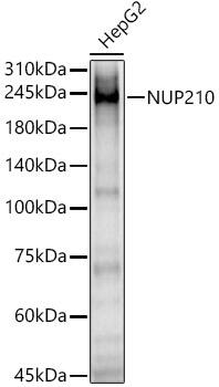 Western Blot NUP210 Antibody