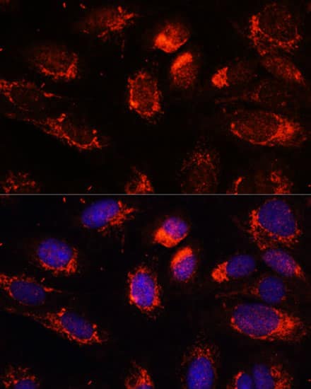 Immunocytochemistry/ Immunofluorescence: NUP210 Antibody [NBP3-37931] - Immunofluorescence analysis of U-2 OS cells using NUP210 Rabbit pAb at dilution of 1:100. Secondary antibody: Cy3-conjugated Goat anti-Rabbit IgG (H+L) at 1:500 dilution. Blue: DAPI for nuclear staining.