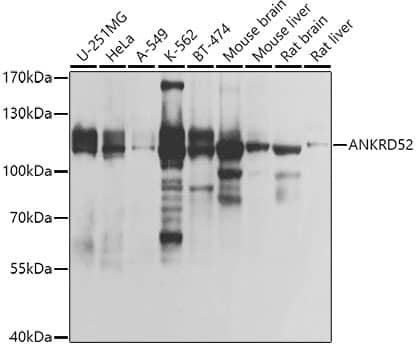 Western Blot: ANKRD52 Antibody [NBP3-37935] - Western blot analysis of various lysates using ANKRD52 Rabbit pAb at 1:1000 dilution.Secondary antibody: HRP-conjugated Goat anti-Rabbit IgG (H+L) at 1:10000 dilution.Lysates/proteins: 25ug per lane.Blocking buffer: 3% nonfat dry milk in TBST.Detection: ECL Basic Kit.Exposure time: 1s.
