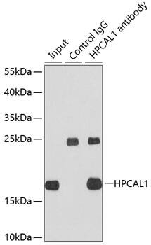 Immunoprecipitation: VILIP3 Antibody [NBP3-37936] - Immunoprecipitation analysis of extracts of HepG2 cells using VILIP3 antibody. Western blot was performed from the immunoprecipitate using VILIP3 antibody at a dilution of 1:1000.