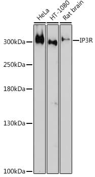 Immunohistochemistry: IP3R1 Antibody [NBP3-37937] - Perform microwave antigen retrieval with 10 mM citrate buffer pH 6.0 before commencing with IF staining protocol.Immunofluorescence analysis of paraffin-embedded Rat Brain using IP3R Rabbit pAb at dilution of 1:200 (40x lens). Secondary antibody: Cy3-conjugated Goat anti-Rabbit IgG (H+L) at 1:500 dilution. Blue: DAPI for nuclear staining.