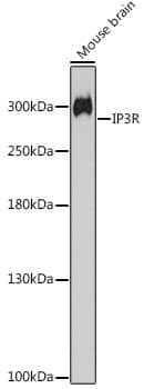 Western Blot: IP3R1 Antibody [NBP3-37937] - Western blot analysis of various lysates using IP3R1 Rabbit pAb at 1:2000 dilution.Secondary antibody: HRP-conjugated Goat anti-Rabbit IgG (H+L) at 1:10000 dilution.Lysates/proteins: 25 ug per lane.Blocking buffer: 3% nonfat dry milk in TBST.Detection: ECL Basic Kit.Negative control (NC): A-431.Exposure time: 10s.