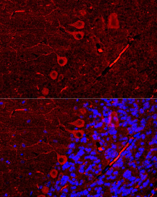 Western Blot: IP3R1 Antibody [NBP3-37937] - Immunoprecipitation of IP3R from 500 ug extracts of SH-SY5Y cells was performed using IP3R1 Rabbit pAb. Rabbit IgG isotype control was used to precipitate the Control IgG sample. IP samples were eluted with 1X Laemmli Buffer. The Input lane represents 10% of the total input. Western blot analysis of immunoprecipitates was conducted using IP3R Rabbit pAb at a dilution of 1:2500.