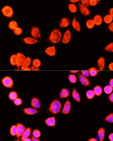 Immunocytochemistry/ Immunofluorescence: Glutathione S Transferase kappa 1 Antibody [NBP3-37938] - Immunofluorescence analysis of Hela cells using [KO Validated] Glutathione S Transferase kappa 1 Rabbit pAb at dilution of 1:100 (40x lens). Secondary antibody: Cy3-conjugated Goat anti-Rabbit IgG (H+L) at 1:500 dilution. Blue: DAPI for nuclear staining.