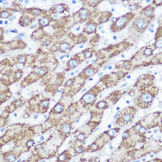 Immunohistochemistry NDUFA4 Antibody