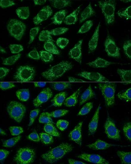 Immunocytochemistry/ Immunofluorescence NDUFA4 Antibody