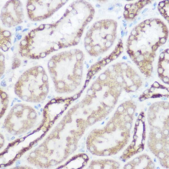 Immunohistochemistry NDUFA4 Antibody