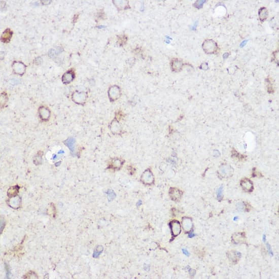 Immunohistochemistry: NDUFA4 Antibody [NBP3-37940] - Immunohistochemistry analysis of paraffin-embedded Mouse brain using NDUFA4 Rabbit pAb at dilution of 1:100 (40x lens). High pressure antigen retrieval performed with 0.01M Citrate Bufferr (pH 6.0) prior to IHC staining.