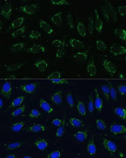 Immunocytochemistry/ Immunofluorescence: NDUFA4 Antibody [NBP3-37940] - Immunofluorescence analysis of U-2 OS cells using [KO Validated] NDUFA4 Rabbit pAb at dilution of 1:100 (40x lens). Secondary antibody: Cy3-conjugated Goat anti-Rabbit IgG (H+L) at 1:500 dilution. Blue: DAPI for nuclear staining.